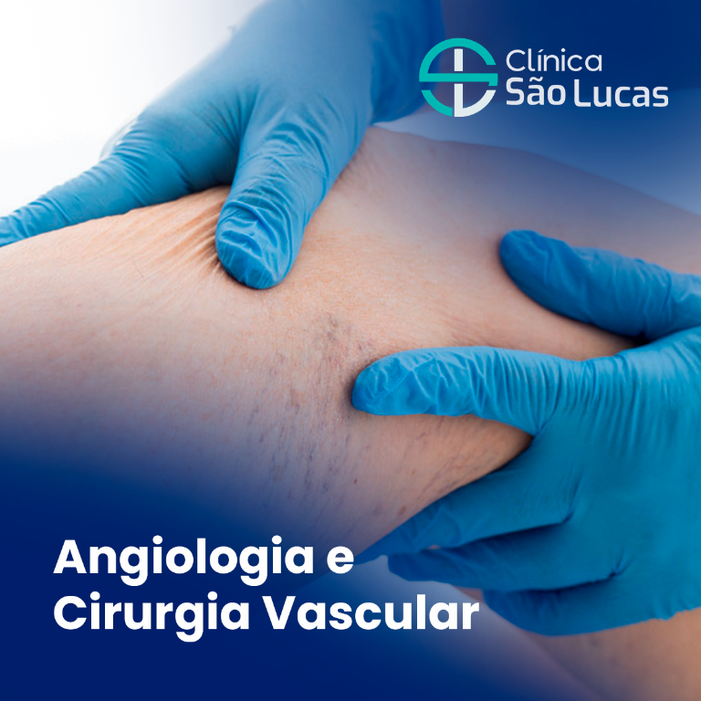 Angiologia e Cirurgia Vascular